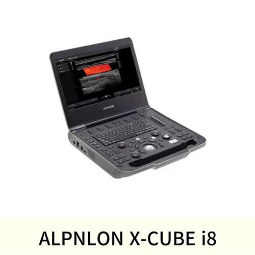 초음파영상진단장치- ALPNLON X-CUBE i8