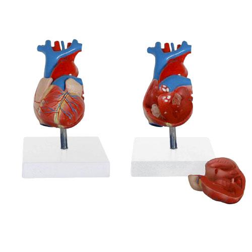 표준형 심장 모형